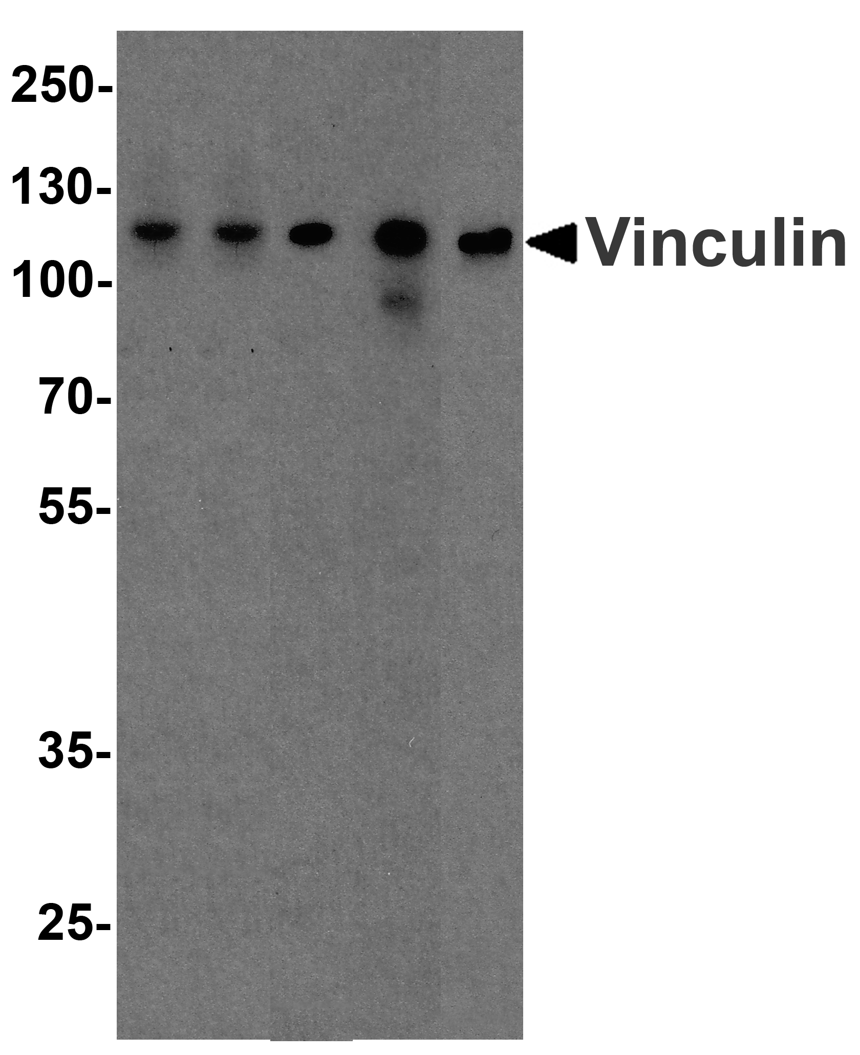 VCL / Vinculin Antibody
