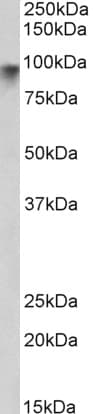 IHC-plus™ Polyclonal Goat anti-Human NLGN2 / Neuroligin 2 Antibody (aa165-177, IHC, WB)