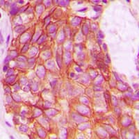 Polyclonal Rabbit anti-Human ACKR3 / CXCR7 Antibody (C-Terminus, IHC, WB)