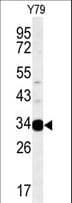 AIG1 Antibody (aa53-81)