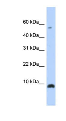 CXCL6 Antibody (C-Terminus)