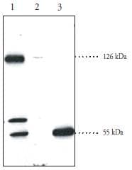 IHC-plus™ Polyclonal Rabbit anti-Human SREBF2 / SREBP2 Antibody (aa455-469, IHC, WB)