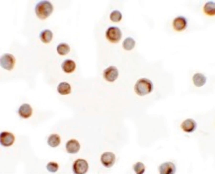 IHC-plus™ Polyclonal Rabbit anti-Human RILP Antibody (IHC, IF, WB)