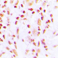 CHEK2 / CHK2 Antibody (phospho-Thr387)