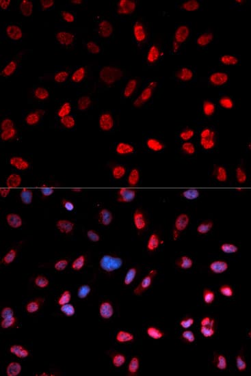 Polyclonal Rabbit anti-Human ATF2 Antibody (phospho-Thr53, IHC, IF, WB)