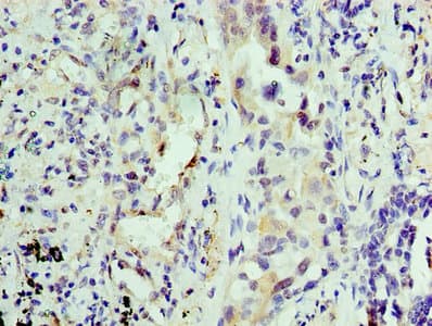 KPNA1 / Importin Alpha 5 Antibody