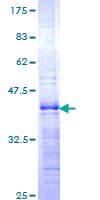 Human ZHX1 Protein (Recombinant GST, N-terminus)
