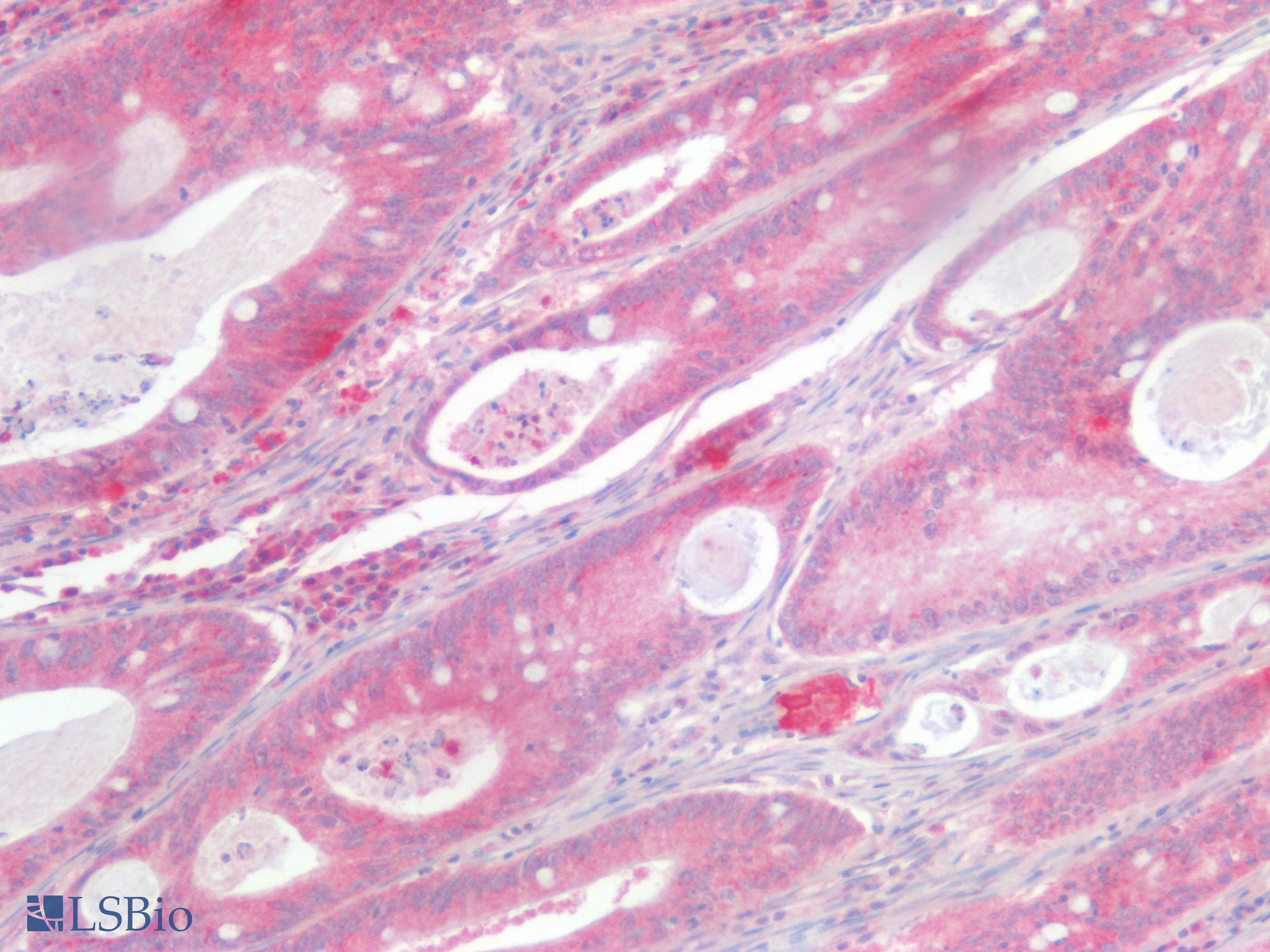 IHC-plus™ KRAS Antibody