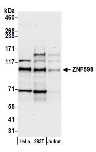 ZNF598 Antibody (aa375-425)