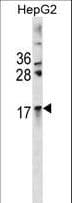 Polyclonal Rabbit anti-Human CRYAA / Alpha A Crystallin Antibody (aa77-106, WB)