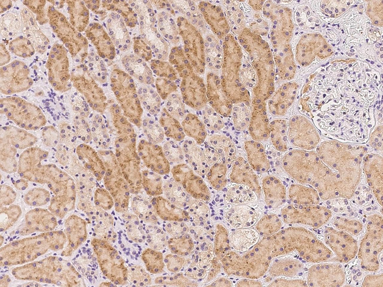 Polyclonal Rabbit anti-Human SECISBP2L Antibody (IHC)