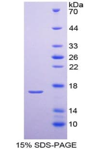 Human PTHR2 / PTH2R Protein (Recombinant His-T7)