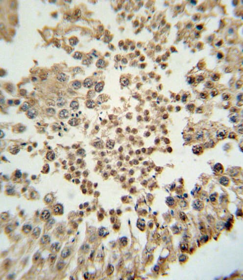 EZH2 Antibody