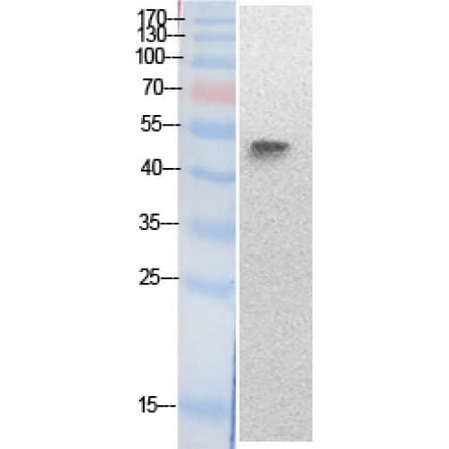 TP53 / p53 Antibody (around the acetylation site of K320.)