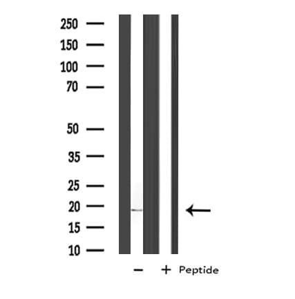 COX5A Antibody