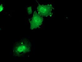 DUSP23 Antibody (clone OTI3C10)