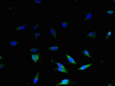 UCP3 Antibody