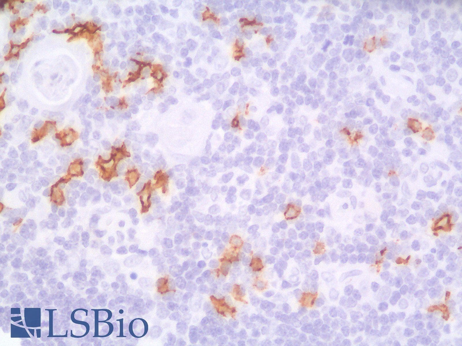 PathPlus™ CD20 Antibody (clone IGEL/1497R)