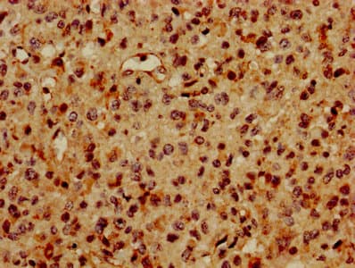 Histone H2B Antibody