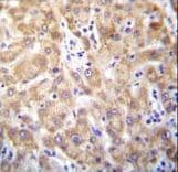 Polyclonal Rabbit anti-Human STX2 / Syntaxin 2 Antibody (aa123-152, IHC, WB)