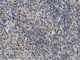 USP10 Antibody (clone OTI2E1)