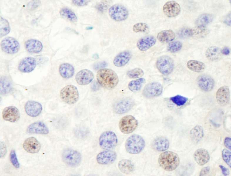 GTF3C1 Antibody (aa475-525)