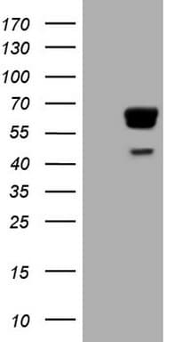 Monoclonal Mouse anti-Human PAK4 Antibody (clone OTI1C7, aa1-308, IHC, WB)