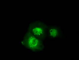 SRR / Serine Racemase Antibody (clone OTI3B5)