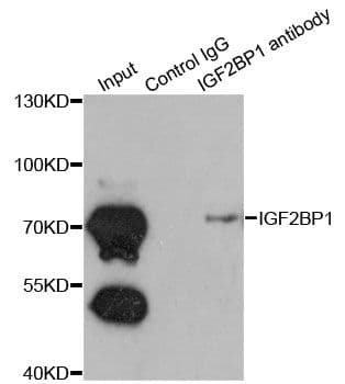 CRD-BP / ZBP1 / IGF2BP1 Antibody