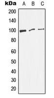 Polyclonal Rabbit anti-Human DNM1 / Dynamin Antibody (phospho-Ser774, WB)