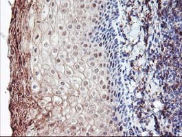 RLBP1 / CRALBP Antibody (clone OTI1G6)