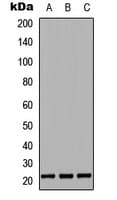 Polyclonal Rabbit anti-Human CSF3 / G-CSF Antibody (Internal, WB)