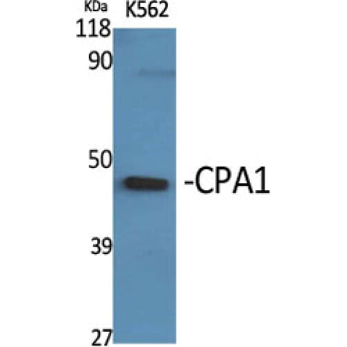 CPA1 / Carboxypeptidase A Antibody (270-350 aa, Internal)
