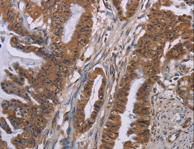Polyclonal Rabbit anti-Human Rhodopsin Kinase / GRK1 Antibody (IHC)