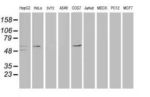 TP53 / p53 Antibody (clone OTI1C6)