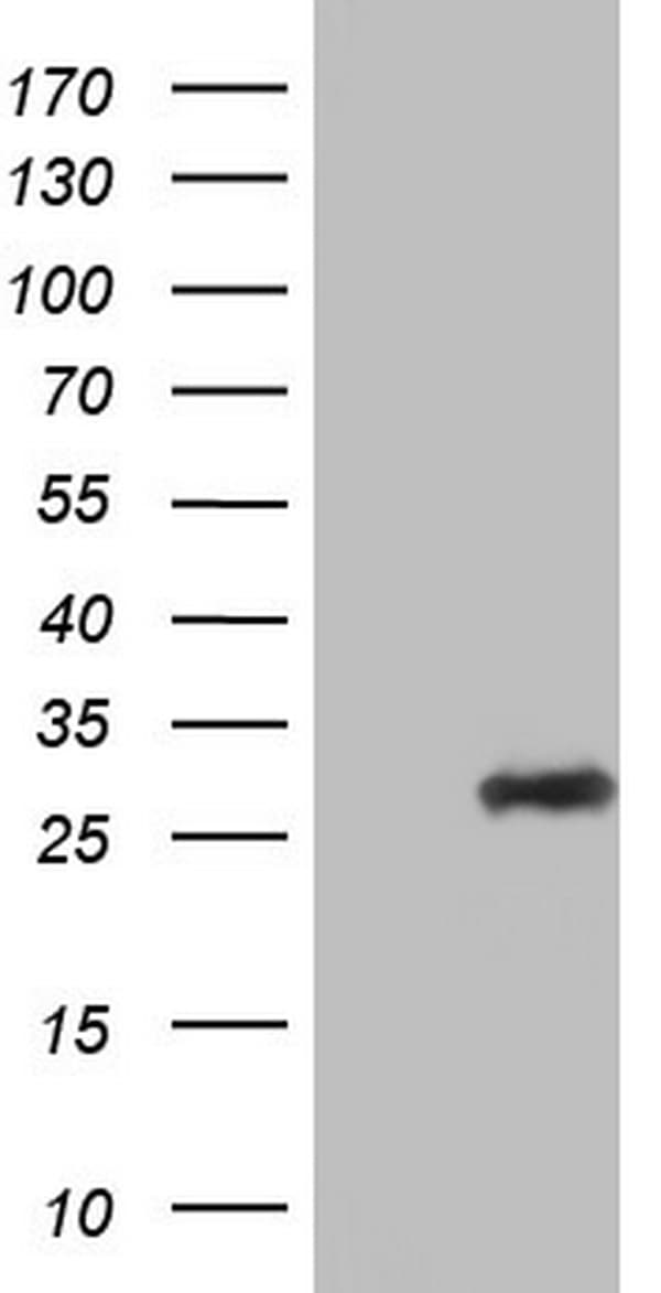 Adiponectin Antibody (aa19-244, clone OTI2E2, Carrier-free)