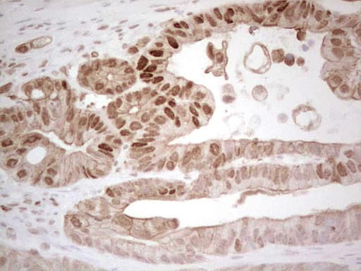 RB1 / Retinoblastoma / RB Antibody (aa309-590, clone OTI10H9)