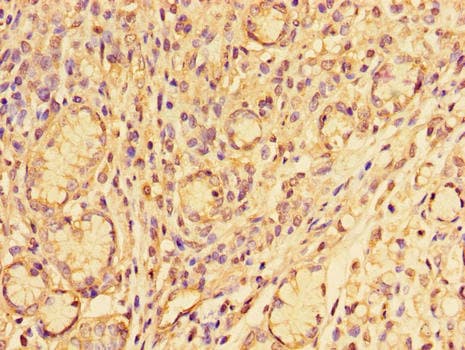 SNAI2 / SLUG Antibody