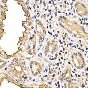 Polyclonal Rabbit anti-Human ARRB2 / Beta Arrestin 2 Antibody (IHC, IF, WB)