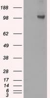 HK2 / Hexokinase 2 Antibody (clone OTI4D4)