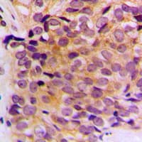 KRT10 / CK10 / Cytokeratin 10 Antibody (Internal)