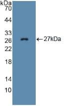 FBN1 / Fibrillin 1 Antibody (aa957-1143)