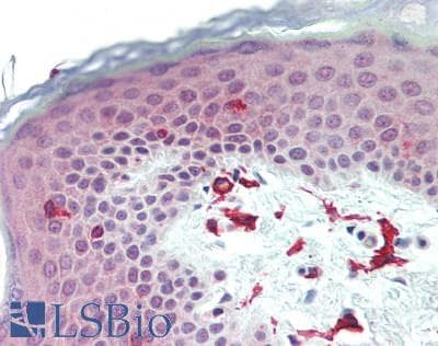 IHC-plus™ Polyclonal Rabbit anti-Human HLA-DRB4 Antibody (IHC, WB)
