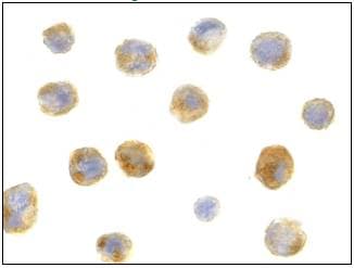 Polyclonal Rabbit anti-Human BECN1 / Beclin-1 Antibody (IHC, IF, WB)