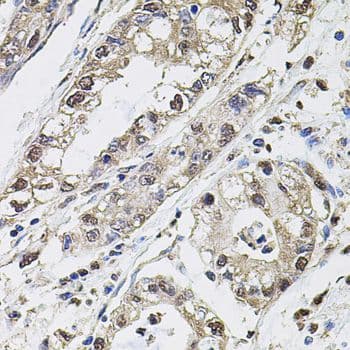 CA9 / Carbonic Anhydrase IX Antibody