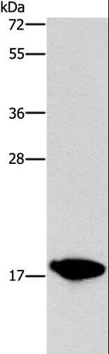 CCL16 / LEC Antibody