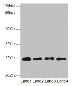 RPS8 / Ribosomal Protein S8 Antibody