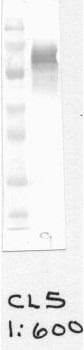 CYBB / NOX2 / gp91phox Antibody (clone CL5)