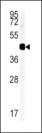 HSD17B2 Antibody (aa265-294)