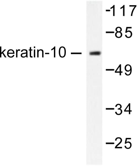 KRT10 / CK10 / Cytokeratin 10 Antibody (Tyr160)